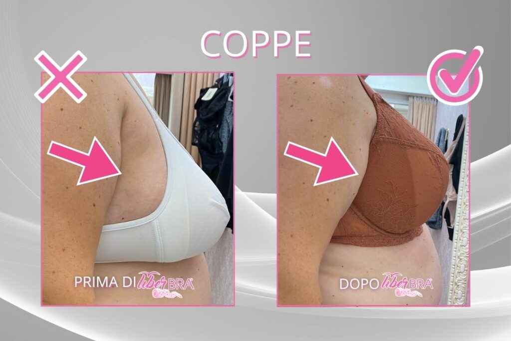 Prima-dopo-coppe-di-lato