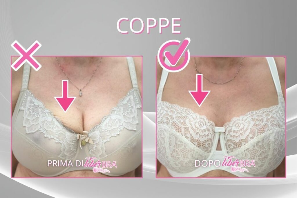 Prima-dopo-coppe-frontale