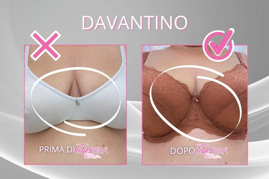 Prima-dopo-davantino