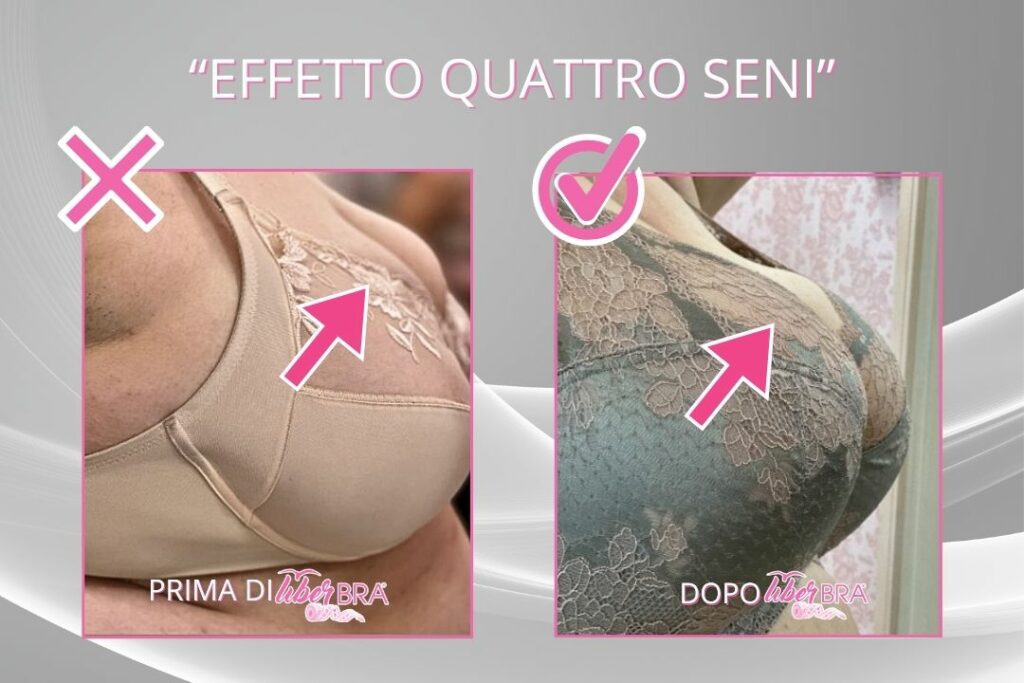 Prima-dopo-effetto-quattro-seni