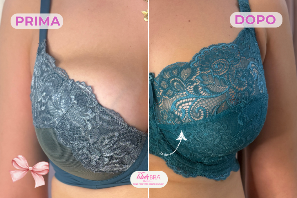 bra fitting prime e dopo reggiseni su misura azzurro