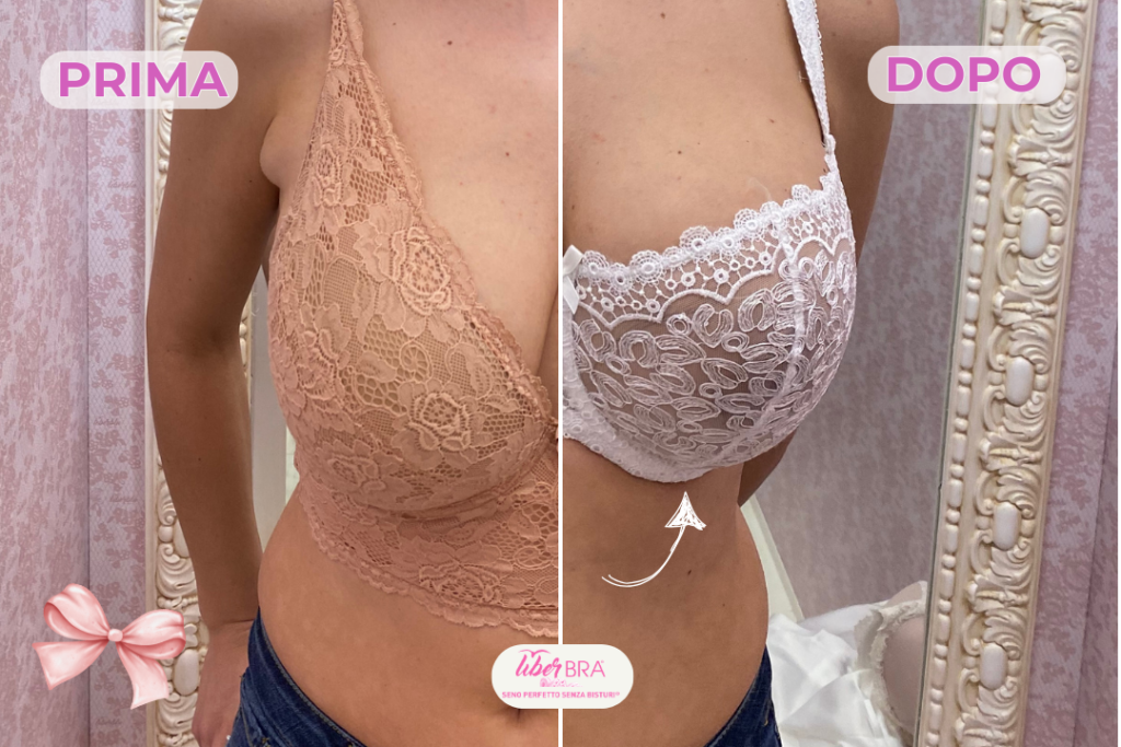 prima e dopo bra fitting