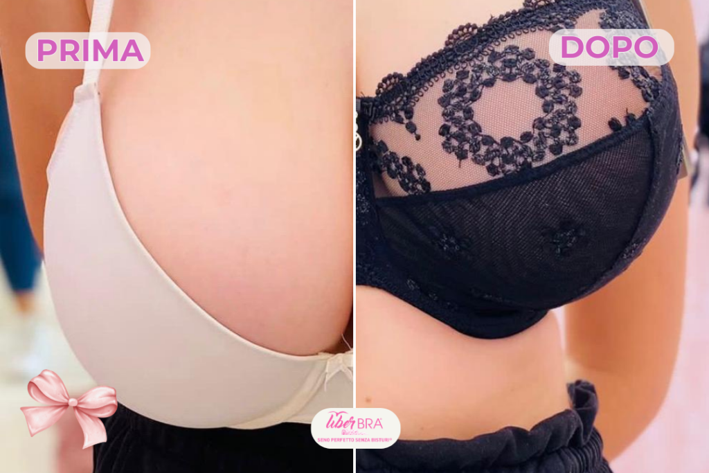 prima e dopo bra fitting