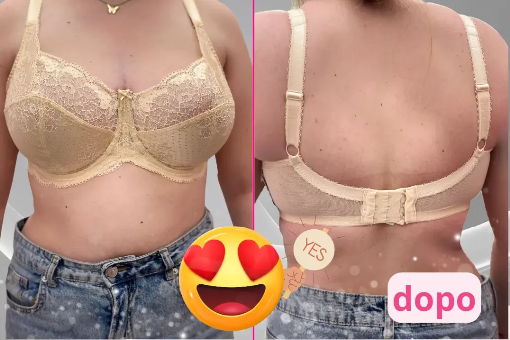 reggiseno liberbra dopo